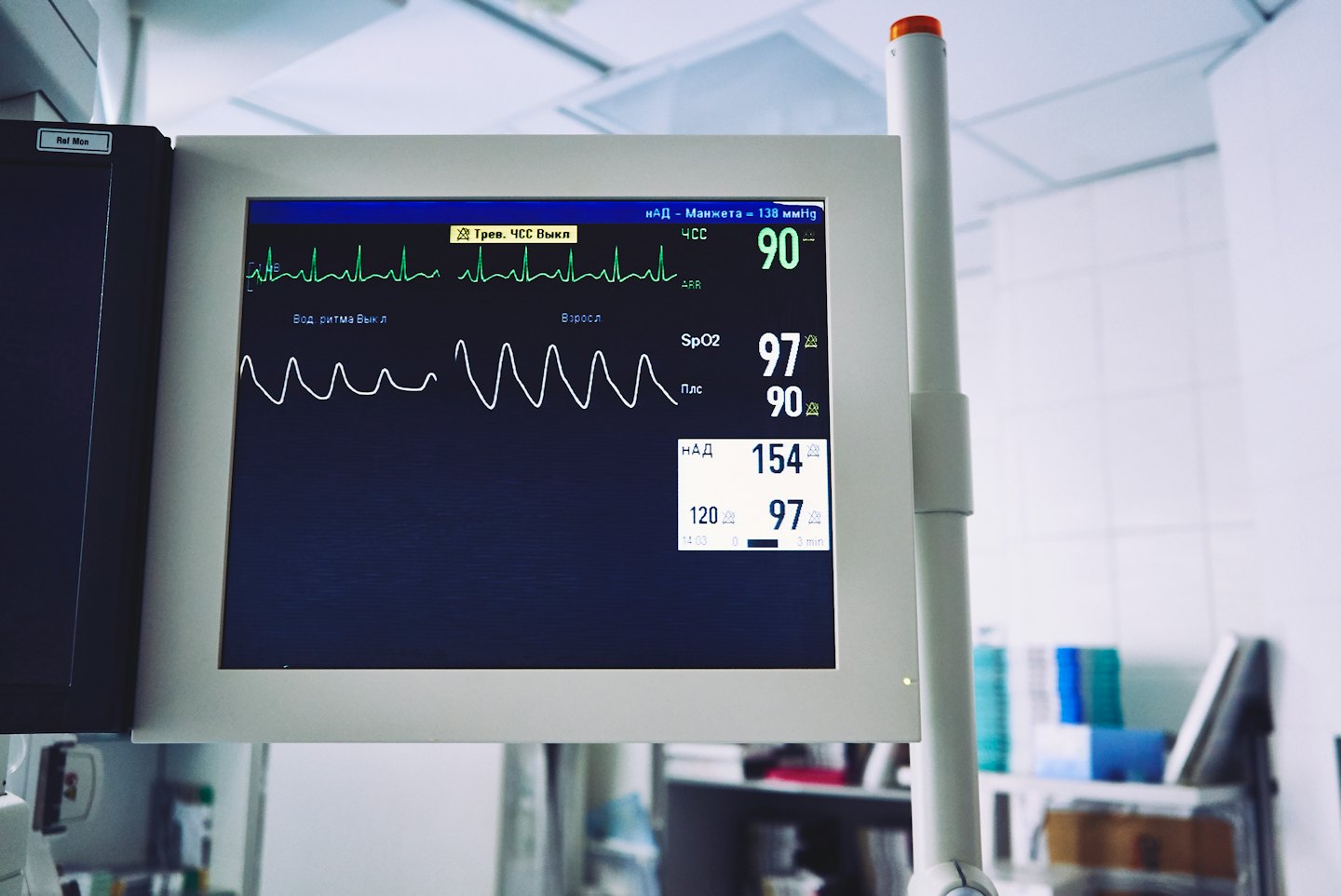 Monitor médico muestra signos vitales del paciente y trazado de ECG.
